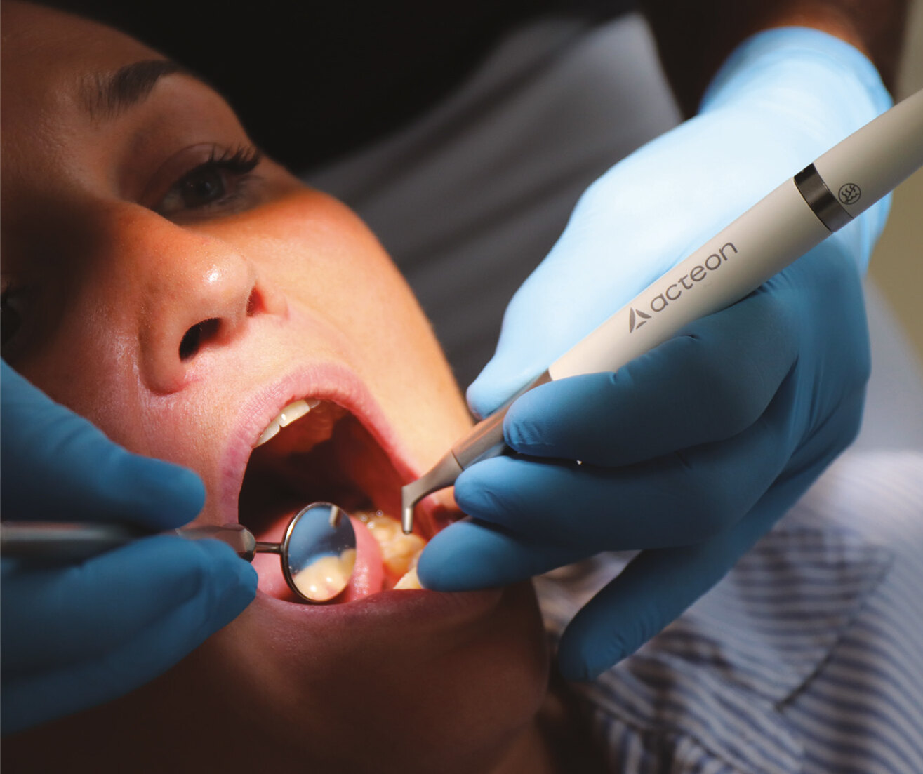 An ACTEON handpiece guided with precision during an intraoral examination